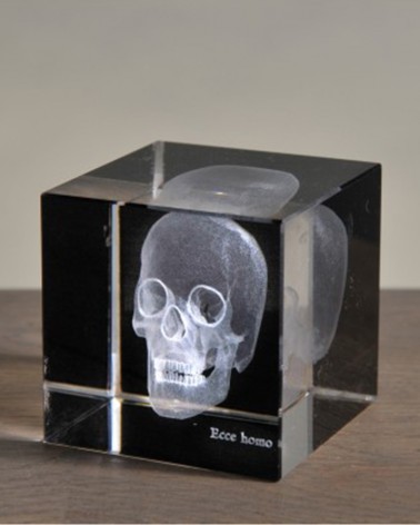 Radio d'un crâne en 3D