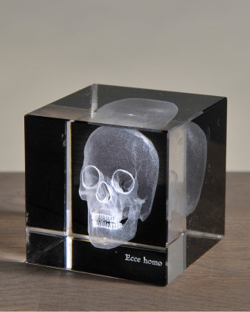 3D skull X-ray