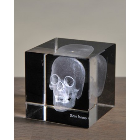 3D skull X-ray